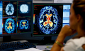 Lekarz w trakcie specjalizacji w dziedzinie radiologia i diagnostyka obrazowa - ​​Zakład Radiologii Lekarskiej WIM-PIB (kontrakt)