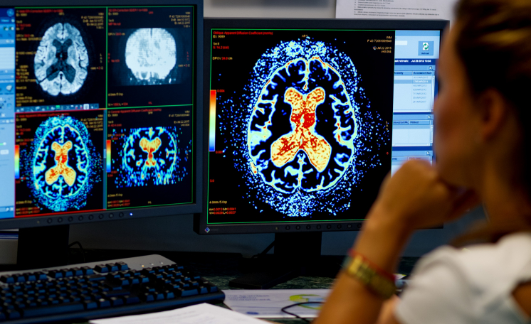Lekarz w trakcie specjalizacji w dziedzinie radiologia i diagnostyka obrazowa - ​​Zakład Radiologii Lekarskiej WIM-PIB (kontrakt)