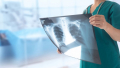 Elektroradiolog - Pracownia RTG Zakładu Radiologii Lekarskiej WIM-PIB (kontrakt)