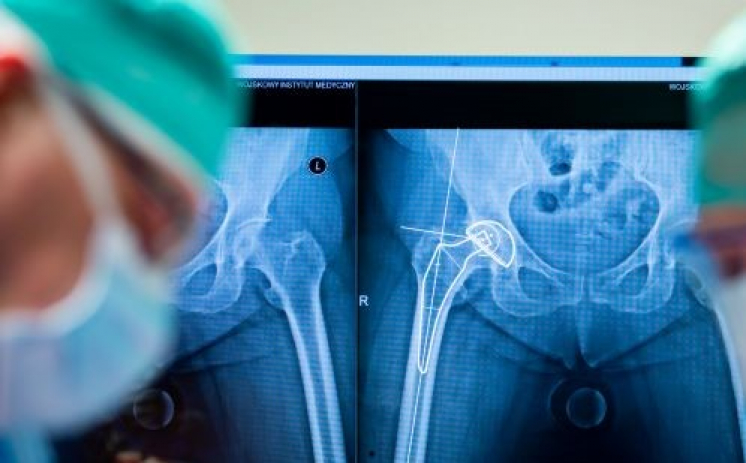 Lekarz posiadający specjalizację w dziedzinie ortopedia i traumatologia narządu ruchu - Klinika Traumatologii i Ortopedii WIM-PIB (kontrakt)